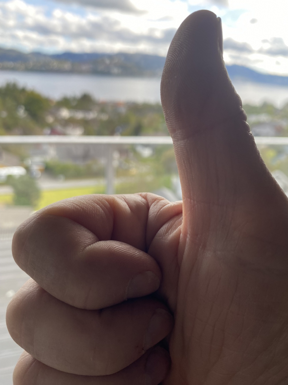 Gledelige nyheter fra uniQure om Huntingtons sykdom. 